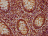 IHC image of CSB-PA621644NA01HU diluted at 1:840 and staining in paraffin-embedded human appendix tissue performed on a Leica BondTM system. After dewaxing and hydration, antigen retrieval was mediated by high pressure in a citrate buffer (pH 6.0) . Section was blocked with 10% normal goat serum 30min at RT. Then primary antibody (1% BSA) was incubated at 4°C overnight. The primary is detected by a biotinylated secondary antibody and visualized using an HRP conjugated SP system.