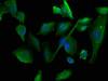 Immunofluorescence staining of U251 cells with CSB-PA750884LA01HU at 1:50, counter-stained with DAPI. The cells were fixed in 4% formaldehyde, permeabilized using 0.2% Triton X-100 and blocked in 10% normal Goat Serum. The cells were then incubated with the antibody overnight at 4°C. The secondary antibody was Alexa Fluor 488-congugated AffiniPure Goat Anti-Rabbit IgG (H+L) .