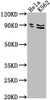 Western Blot<br />
 Positive WB detected in: Hela whole cell lysate, K562 whole cell lysate<br />
 All lanes: SUPV3L1 antibody at 1:2000<br />
 Secondary<br />
 Goat polyclonal to rabbit IgG at 1/50000 dilution<br />
 Predicted band size: 88 kDa<br />
 Observed band size: 88 kDa<br />