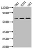 Western Blot<br />
 Positive WB detected in: 293 whole cell lysate, U251 whole cell lysate, U87 whole cell lysate<br />
 All lanes: TCF7L1 antibody at 1:1000<br />
 Secondary<br />
 Goat polyclonal to rabbit IgG at 1/50000 dilution<br />
 Predicted band size: 63 kDa<br />
 Observed band size: 63 kDa<br />