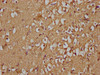 IHC image of CSB-PA009614OA01HU diluted at 1:100 and staining in paraffin-embedded human brain tissue performed on a Leica BondTM system. After dewaxing and hydration, antigen retrieval was mediated by high pressure in a citrate buffer (pH 6.0) . Section was blocked with 10% normal goat serum 30min at RT. Then primary antibody (1% BSA) was incubated at 4°C overnight. The primary is detected by a biotinylated secondary antibody and visualized using an HRP conjugated SP system.