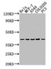 Western Blot<br />
 Positive WB detected in: Hela whole cell lysate, MCF-7 whole cell lysate, A549 whole cell lysate, COLO205 whole cell lysate, PC-3 whole cell lysate<br />
 All lanes: LPAR2 antibody at 1:2000<br />
 Secondary<br />
 Goat polyclonal to rabbit IgG at 1/50000 dilution<br />
 Predicted band size: 40 kDa<br />
 Observed band size: 40 kDa<br />