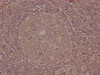 IHC image of CSB-PA868360NA01HU diluted at 1:100 and staining in paraffin-embedded human tonsil tissue performed on a Leica BondTM system. After dewaxing and hydration, antigen retrieval was mediated by high pressure in a citrate buffer (pH 6.0) . Section was blocked with 10% normal goat serum 30min at RT. Then primary antibody (1% BSA) was incubated at 4°C overnight. The primary is detected by a biotinylated secondary antibody and visualized using an HRP conjugated SP system.