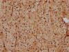 IHC image of CSB-PA878932OA01HU diluted at 1:400 and staining in paraffin-embedded human adrenal gland tissue performed on a Leica BondTM system. After dewaxing and hydration, antigen retrieval was mediated by high pressure in a citrate buffer (pH 6.0) . Section was blocked with 10% normal goat serum 30min at RT. Then primary antibody (1% BSA) was incubated at 4°C overnight. The primary is detected by a biotinylated secondary antibody and visualized using an HRP conjugated SP system.