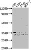 Western Blot<br />
 Positive WB detected in: U87 whole cell lysate, U251 whole cell lysate, A549 whole cell lysate, MCF-7 whole cell lysate<br />
 All lanes: ATP6V1D antibody at 1:2000<br />
 Secondary<br />
 Goat polyclonal to rabbit IgG at 1/50000 dilution<br />
 Predicted band size: 29 kDa<br />
 Observed band size: 29 kDa<br />