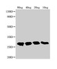 Western Blot<br />
 Positive WB detected in Recombinant protein<br />
 All lanes: TTYH2 antibody at 1:2000<br />
 Secondary<br />
 Goat polyclonal to rabbit IgG at 1/50000 dilution<br />
 Predicted band size: 22.9 kDa<br />
 Observed band size: 28 kDa<br />