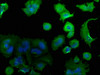 Immunofluorescence staining of MCF-7 cells with CSB-PA004470NA01HU at 1:50, counter-stained with DAPI. The cells were fixed in 4% formaldehyde, permeabilized using 0.2% Triton X-100 and blocked in 10% normal Goat Serum. The cells were then incubated with the antibody overnight at 4°C. The secondary antibody was Alexa Fluor 488-congugated AffiniPure Goat Anti-Rabbit IgG (H+L) .