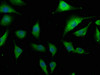 Immunofluorescence staining of U251 cells with CSB-PA005751OA01HU at 1:133, counter-stained with DAPI. The cells were fixed in 4% formaldehyde, permeabilized using 0.2% Triton X-100 and blocked in 10% normal Goat Serum. The cells were then incubated with the antibody overnight at 4°C. The secondary antibody was Alexa Fluor 488-congugated AffiniPure Goat Anti-Rabbit IgG (H+L) .