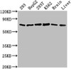 Western Blot<br />
 Positive WB detected in: 293 whole cell lysate, HepG2 whole cell lysate, 293T whole cell lysate, K562 whole cell lysate, Mouse brain tissue, Mouse liver tissue<br />
 All lanes: HSPD1 antibody at 1:2000<br />
 Secondary<br />
 Goat polyclonal to rabbit IgG at 1/50000 dilution<br />
 Predicted band size: 62, 18 kDa<br />
 Observed band size: 62 kDa<br />