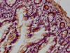 IHC image of CSB-PA012889LA01HU diluted at 1:100 and staining in paraffin-embedded human small intestine tissue performed on a Leica BondTM system. After dewaxing and hydration, antigen retrieval was mediated by high pressure in a citrate buffer (pH 6.0) . Section was blocked with 10% normal goat serum 30min at RT. Then primary antibody (1% BSA) was incubated at 4°C overnight. The primary is detected by a biotinylated secondary antibody and visualized using an HRP conjugated SP system.