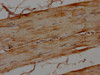 IHC image of CSB-PA013439LA01HU diluted at 1:100 and staining in paraffin-embedded human skeletal muscle tissue performed on a Leica BondTM system. After dewaxing and hydration, antigen retrieval was mediated by high pressure in a citrate buffer (pH 6.0) . Section was blocked with 10% normal goat serum 30min at RT. Then primary antibody (1% BSA) was incubated at 4°C overnight. The primary is detected by a biotinylated secondary antibody and visualized using an HRP conjugated SP system.