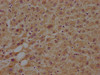 IHC image of CSB-PA013439LA01HU diluted at 1:100 and staining in paraffin-embedded human liver tissue performed on a Leica BondTM system. After dewaxing and hydration, antigen retrieval was mediated by high pressure in a citrate buffer (pH 6.0) . Section was blocked with 10% normal goat serum 30min at RT. Then primary antibody (1% BSA) was incubated at 4°C overnight. The primary is detected by a biotinylated secondary antibody and visualized using an HRP conjugated SP system.