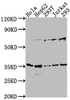 Western Blot<br />
 Positive WB detected in: Hela whole cell lysate, HepG2 whole cell lysate, 293T whole cell lysate, Jurkat whole cell lysate, 293 whole cell lysate<br />
 All lanes: MFF antibody at 1:1000<br />
 Secondary<br />
 Goat polyclonal to rabbit IgG at 1/50000 dilution<br />
 Predicted band size: 39, 33 28, 26 kDa<br />
 Observed band size: 35 kDa<br />