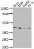 Western Blot<br />
 Positive WB detected in: Hela whole cell lysate, A549 whole cell lysate, HepG2 whole cell lysate, PC-3 whole cell lysate<br />
 All lanes: LPAR6 antibody at 1:2000<br />
 Secondary<br />
 Goat polyclonal to rabbit IgG at 1/50000 dilution<br />
 Predicted band size: 40 kDa<br />
 Observed band size: 40 kDa<br />