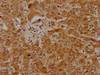 IHC image of CSB-PA018188LA01HU diluted at 1:1000 and staining in paraffin-embedded human liver tissue performed on a Leica BondTM system. After dewaxing and hydration, antigen retrieval was mediated by high pressure in a citrate buffer (pH 6.0) . Section was blocked with 10% normal goat serum 30min at RT. Then primary antibody (1% BSA) was incubated at 4°C overnight. The primary is detected by a biotinylated secondary antibody and visualized using an HRP conjugated SP system.