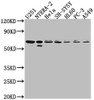 Western Blot<br />
 Positive WB detected in: U251 whole cell lysate, NTERA-2 whole cell lysate, Hela whole cell lysate, SH-SY5Y whole cell lysate, HL60 whole cell lysate, PC-3 whole cell lysate, A549 whole cell lysate<br />
 All lanes: CDK17 antibody at 1:2000<br />
 Secondary<br />
 Goat polyclonal to rabbit IgG at 1/50000 dilution<br />
 Predicted band size: 60 kDa<br />
 Observed band size: 60 kDa<br />