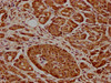 IHC image of CSB-PA28369A0Rb diluted at 1:600 and staining in paraffin-embedded human pancreatic cancer performed on a Leica BondTM system. After dewaxing and hydration, antigen retrieval was mediated by high pressure in a citrate buffer (pH 6.0) . Section was blocked with 10% normal goat serum 30min at RT. Then primary antibody (1% BSA) was incubated at 4°C overnight. The primary is detected by a biotinylated secondary antibody and visualized using an HRP conjugated SP system.