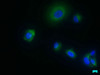 Immunofluorescence staining of MCF-7 cells with CSB-PA457545LA01HU at 1:50, counter-stained with DAPI. The cells were fixed in 4% formaldehyde, permeabilized using 0.2% Triton X-100 and blocked in 10% normal Goat Serum. The cells were then incubated with the antibody overnight at 4°C. The secondary antibody was Alexa Fluor 488-congugated AffiniPure Goat Anti-Rabbit IgG (H+L) .