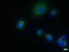 Immunofluorescence staining of MCF-7 cells with CSB-PA457545LA01HU at 1:50, counter-stained with DAPI. The cells were fixed in 4% formaldehyde, permeabilized using 0.2% Triton X-100 and blocked in 10% normal Goat Serum. The cells were then incubated with the antibody overnight at 4°C. The secondary antibody was Alexa Fluor 488-congugated AffiniPure Goat Anti-Rabbit IgG (H+L) . Immunofluorescence staining of MCF-7 cells with CSB-PA457545LA01HU at 1:50, counter-stained with DAPI. The cells were fixed in 4% formaldehyde, permeabilized using 0.2% Triton X-100 and blocked in 10% normal Goat Serum. The cells were then incubated with the antibody overnight at 4°C. The secondary antibody was Alexa Fluor 488-congugated AffiniPure Goat Anti-Rabbit IgG (H+L) .