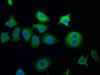 Immunofluorescence staining of A549 cells with CSB-PA856945LA01HU at 1:50, counter-stained with DAPI. The cells were fixed in 4% formaldehyde, permeabilized using 0.2% Triton X-100 and blocked in 10% normal Goat Serum. The cells were then incubated with the antibody overnight at 4°C. The secondary antibody was Alexa Fluor 488-congugated AffiniPure Goat Anti-Rabbit IgG (H+L) .