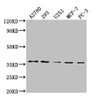 Western Blot<br />
 Positive WB detected in: A2780 whole cell lysate, 293 whole cell lysate, U251 whole cell lysate, MCF-7 whole cell lysate, PC-3 whole cell lysate<br />
 All lanes: PDCL3 antibody at 1:2000<br />
 Secondary<br />
 Goat polyclonal to rabbit IgG at 1/50000 dilution<br />
 Predicted band size: 28 kDa<br />
 Observed band size: 37 kDa<br />