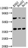 Western Blot<br />
 Positive WB detected in: K562 whole cell lysate, HepG2 whole cell lysate, Hela whole cell lysate<br />
 All lanes: CFHR5 antibody at 1:1000<br />
 Secondary<br />
 Goat polyclonal to rabbit IgG at 1/50000 dilution<br />
 Predicted band size: 65 kDa<br />
 Observed band size: 65 kDa<br />