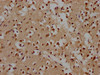 IHC image of CSB-PA897542LA01HU diluted at 1:100 and staining in paraffin-embedded human brain tissue performed on a Leica BondTM system. After dewaxing and hydration, antigen retrieval was mediated by high pressure in a citrate buffer (pH 6.0) . Section was blocked with 10% normal goat serum 30min at RT. Then primary antibody (1% BSA) was incubated at 4°C overnight. The primary is detected by a biotinylated secondary antibody and visualized using an HRP conjugated SP system.
