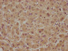 IHC image of CSB-PA009810OA01HU diluted at 1:100 and staining in paraffin-embedded human liver tissue performed on a Leica BondTM system. After dewaxing and hydration, antigen retrieval was mediated by high pressure in a citrate buffer (pH 6.0) . Section was blocked with 10% normal goat serum 30min at RT. Then primary antibody (1% BSA) was incubated at 4°C overnight. The primary is detected by a biotinylated secondary antibody and visualized using an HRP conjugated SP system.