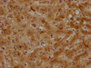 IHC image of CSB-PA001932OA01HU diluted at 1:500 and staining in paraffin-embedded human liver tissue performed on a Leica BondTM system. After dewaxing and hydration, antigen retrieval was mediated by high pressure in a citrate buffer (pH 6.0) . Section was blocked with 10% normal goat serum 30min at RT. Then primary antibody (1% BSA) was incubated at 4°C overnight. The primary is detected by a biotinylated secondary antibody and visualized using an HRP conjugated SP system.