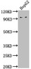 Western Blot<br />
 Positive WB detected in: HepG2 whole cell lysate<br />
 All lanes: AVIL antibody at 1:2000<br />
 Secondary<br />
 Goat polyclonal to rabbit IgG at 1/50000 dilution<br />
 Predicted band size: 93, 92 kDa<br />
 Observed band size: 93 kDa<br />