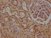 IHC image of CSB-PA004432LA01HU diluted at 1:1000 and staining in paraffin-embedded human kidney tissue performed on a Leica BondTM system. After dewaxing and hydration, antigen retrieval was mediated by high pressure in a citrate buffer (pH 6.0) . Section was blocked with 10% normal goat serum 30min at RT. Then primary antibody (1% BSA) was incubated at 4°C overnight. The primary is detected by a biotinylated secondary antibody and visualized using an HRP conjugated SP system.