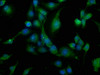 Immunofluorescence staining of U251 cells with CSB-PA004432LA01HU at 1:200, counter-stained with DAPI. The cells were fixed in 4% formaldehyde, permeabilized using 0.2% Triton X-100 and blocked in 10% normal Goat Serum. The cells were then incubated with the antibody overnight at 4°C. The secondary antibody was Alexa Fluor 488-congugated AffiniPure Goat Anti-Rabbit IgG (H+L) .