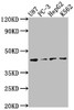 Western Blot<br />
 Positive WB detected in: U87 whole cell lysate, PC-3 whole cell lysate, HepG2 whole cell lysate, K562 whole cell lysate<br />
 All lanes: OPCML antibody at 1:2000<br />
 Secondary<br />
 Goat polyclonal to rabbit IgG at 1/50000 dilution<br />
 Predicted band size: 39, 38, 34 kDa<br />
 Observed band size: 39 kDa<br />