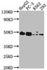 Western Blot<br />
 Positive WB detected in: HepG2 whole cell lysate, PC-3 whole cell lysate, K562 whole cell lysate, 293 whole cell lysate<br />
 All lanes: POGLUT1 antibody at 1:2000<br />
 Secondary<br />
 Goat polyclonal to rabbit IgG at 1/50000 dilution<br />
 Predicted band size: 47 kDa<br />
 Observed band size: 47 kDa<br />