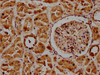 IHC image of CSB-PA818754LA01HU diluted at 1:300 and staining in paraffin-embedded human kidney tissue performed on a Leica BondTM system. After dewaxing and hydration, antigen retrieval was mediated by high pressure in a citrate buffer (pH 6.0) . Section was blocked with 10% normal goat serum 30min at RT. Then primary antibody (1% BSA) was incubated at 4°C overnight. The primary is detected by a biotinylated secondary antibody and visualized using an HRP conjugated SP system.