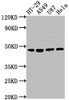 Western Blot<br />
 Positive WB detected in: HT-29 whole cell lysate, A549 whole cell lysate, U87 whole cell lysate, Hela whole cell lysate<br />
 All lanes: DPEP1 antibody at 1:2000<br />
 Secondary<br />
 Goat polyclonal to rabbit IgG at 1/50000 dilution<br />
 Predicted band size: 46 kDa<br />
 Observed band size: 46 kDa<br />