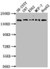 Western Blot<br />
 Positive WB detected in: SH-SY5Y whole cell lysate, U87 whole cell lysate, K562 whole cell lysate, MCF-7 whole cell lysatee, HepG2 whole cell lysate<br />
 All lanes: INSRR antibody at 1:2000<br />
 Secondary<br />
 Goat polyclonal to rabbit IgG at 1/50000 dilution<br />
 Predicted band size: 144 kDa<br />
 Observed band size: 144 kDa<br />