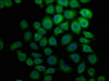 Immunofluorescence staining of A549 cells with CSB-PA748484HA01HU at 1:133, counter-stained with DAPI. The cells were fixed in 4% formaldehyde, permeabilized using 0.2% Triton X-100 and blocked in 10% normal Goat Serum. The cells were then incubated with the antibody overnight at 4°C. The secondary antibody was Alexa Fluor 488-congugated AffiniPure Goat Anti-Rabbit IgG (H+L) .