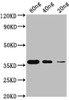Western Blot<br />
 Positive WB detected in Recombinant protein<br />
 All lanes: Copper-metallothionein antibody at 1:2000<br />
 Secondary<br />
 Goat polyclonal to rabbit IgG at 1/50000 dilution<br />
 Predicted band size: 35 KDa<br />
 Observed band size: 35 KDa<br />