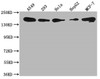 Western Blot<br />
 Positive WB detected in: A549 whole cell lysate, 293 whole cell lysate, Hela whole cell lysate, HepG2 whole cell lysate, MCF-7 whole cell lysate<br />
 All lanes: PLXNB2 antibody at 1:1000<br />
 Secondary<br />
 Goat polyclonal to rabbit IgG at 1/50000 dilution<br />
 Predicted band size: 206 kDa<br />
 Observed band size: 206 kDa<br />