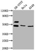 Western Blot<br />
 Positive WB detected in: SH-SY5Y whole cell lysate, Hela whole cell lysate, A549 whole cell lysate<br />
 All lanes: ANGPTL4 antibody at 1:1000<br />
 Secondary<br />
 Goat polyclonal to rabbit IgG at 1/50000 dilution<br />
 Predicted band size: 46, 41, 27 kDa<br />
 Observed band size: 46 kDa<br />