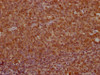 IHC image of CSB-PA04837A0Rb diluted at 1:100 and staining in paraffin-embedded human tonsil tissue performed on a Leica BondTM system. After dewaxing and hydration, antigen retrieval was mediated by high pressure in a citrate buffer (pH 6.0) . Section was blocked with 10% normal goat serum 30min at RT. Then primary antibody (1% BSA) was incubated at 4°C overnight. The primary is detected by a Goat anti-rabbit IgG labeled by HRP and visualized using 0.05% DAB.