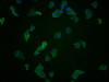 Immunofluorescence staining of Hela cells with CSB-PA002531LA01HU at 1:100, counter-stained with DAPI. The cells were fixed in 4% formaldehyde, permeabilized using 0.2% Triton X-100 and blocked in 10% normal Goat Serum. The cells were then incubated with the antibody overnight at 4°C. The secondary antibody was Alexa Fluor 488-congugated AffiniPure Goat Anti-Rabbit IgG (H+L) .