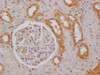 IHC image of CSB-PA853393LA01HU diluted at 1:100 and staining in paraffin-embedded human kidney tissue performed on a Leica BondTM system. After dewaxing and hydration, antigen retrieval was mediated by high pressure in a citrate buffer (pH 6.0) . Section was blocked with 10% normal goat serum 30min at RT. Then primary antibody (1% BSA) was incubated at 4°C overnight. The primary is detected by a Goat anti-rabbit IgG labeled by HRP and visualized using 0.05% DAB.