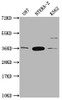 Western Blot<br />
 Positive WB detected in: U87 whole cell lysate, NTERA-2 whole cell lysate, K562 whole cell lysate<br />
 All lanes: CBY1 antibody at 1:2000<br />
 Secondary<br />
 Goat polyclonal to rabbit IgG at 1/50000 dilution<br />
 Predicted band size: 15 kDa<br />
 Observed band size: 35 kDa<br />