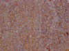 IHC image of CSB-PA020626HA01HU diluted at 1:100 and staining in paraffin-embedded human tonsil tissue performed on a Leica BondTM system. After dewaxing and hydration, antigen retrieval was mediated by high pressure in a citrate buffer (pH 6.0) . Section was blocked with 10% normal goat serum 30min at RT. Then primary antibody (1% BSA) was incubated at 4°C overnight. The primary is detected by a Goat anti-rabbit IgG labeled by HRP and visualized using 0.05% DAB.