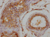 IHC image of CSB-PA026120LA01HU diluted at 1:200 and staining in paraffin-embedded human testis tissue performed on a Leica BondTM system. After dewaxing and hydration, antigen retrieval was mediated by high pressure in a citrate buffer (pH 6.0) . Section was blocked with 10% normal goat serum 30min at RT. Then primary antibody (1% BSA) was incubated at 4°C overnight. The primary is detected by a Goat anti-rabbit IgG labeled by HRP and visualized using 0.05% DAB.