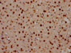 IHC image of CSB-PA892170LA01HU diluted at 1:100 and staining in paraffin-embedded human brain tissue performed on a Leica BondTM system. After dewaxing and hydration, antigen retrieval was mediated by high pressure in a citrate buffer (pH 6.0) . Section was blocked with 10% normal goat serum 30min at RT. Then primary antibody (1% BSA) was incubated at 4°C overnight. The primary is detected by a Goat anti-rabbit IgG labeled by HRP and visualized using 0.05% DAB.