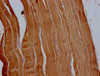 IHC image of CSB-PA001242LA11HU diluted at 1:500 and staining in paraffin-embedded human skeletal muscle tissue performed on a Leica BondTM system. After dewaxing and hydration, antigen retrieval was mediated by high pressure in a citrate buffer (pH 6.0) . Section was blocked with 10% normal goat serum 30min at RT. Then primary antibody (1% BSA) was incubated at 4°C overnight. The primary is detected by a Goat anti-rabbit polymer IgG labeled by HRP and visualized using 0.05% DAB.