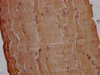 IHC image of CSB-PA754631LA01HU diluted at 1:200 and staining in paraffin-embedded human skeletal muscle tissue performed on a Leica BondTM system. After dewaxing and hydration, antigen retrieval was mediated by high pressure in a citrate buffer (pH 6.0) . Section was blocked with 10% normal goat serum 30min at RT. Then primary antibody (1% BSA) was incubated at 4°C overnight. The primary is detected by a Goat anti-rabbit polymer IgG labeled by HRP and visualized using 0.05% DAB.